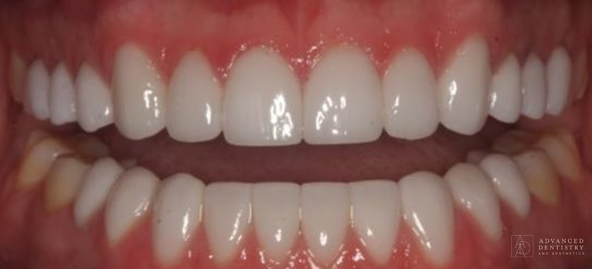 Advanced Cosmetic Dentistry - Paul Peterson, DDS