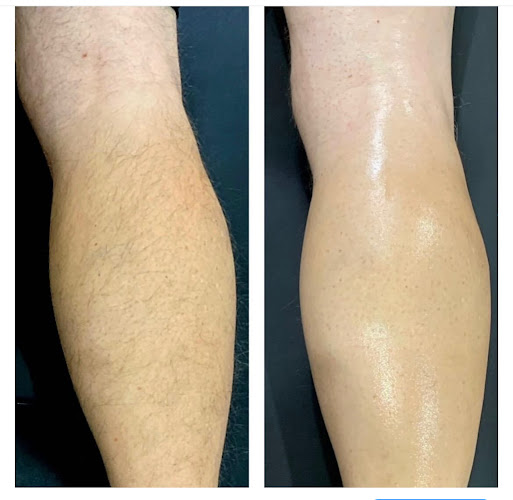 Bare Esthetics Studio