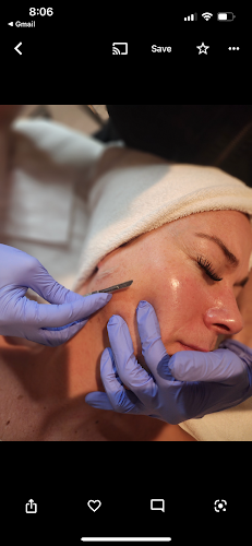 Divine Skin Aesthetics | Laser Skincare
