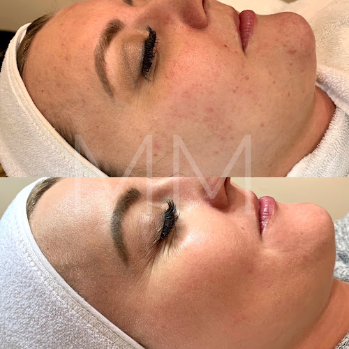 MM SKINCARE + ACNE CLINIC