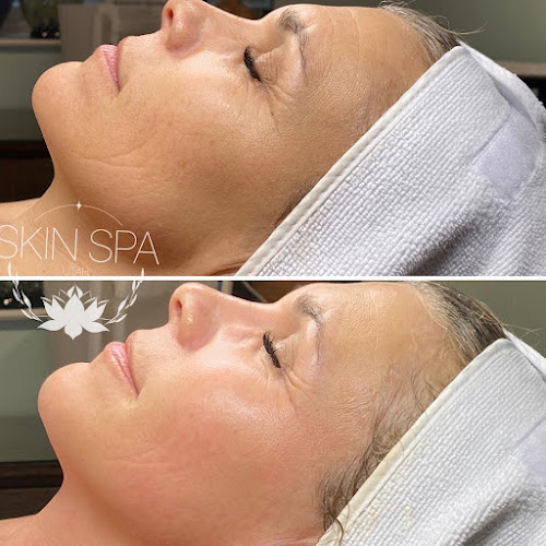 Skin Spa Utah