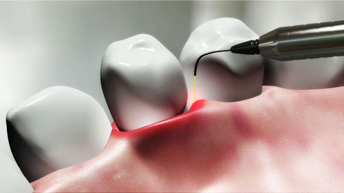 Silver Creek Dental Of Payson